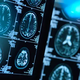 Neurology