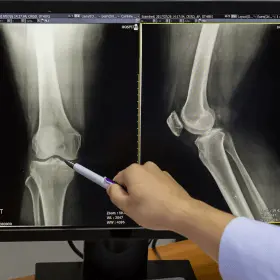 Orthopaedics
